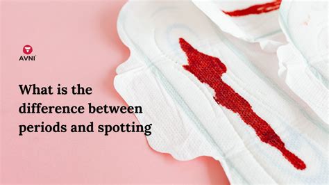 What Is the Difference Between Periods and Spotting?