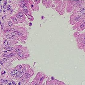 How One Scientist Uses T Cell Research to… | Riley Children's Health