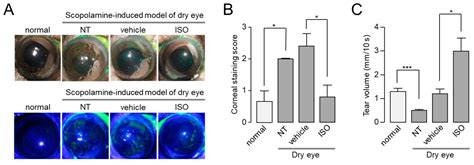 Isorhamnetin Ameliorates Dry Eye Disease via CFTR Activation in Mice
