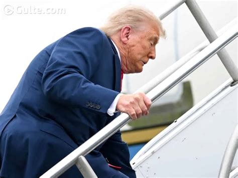 Trump Diagnosed With Chronic venous Insufficiency