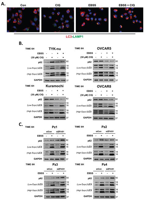 ZFAS1 Orchestrates Stress-Induced Autophagy in Ovarian Cancer via ...