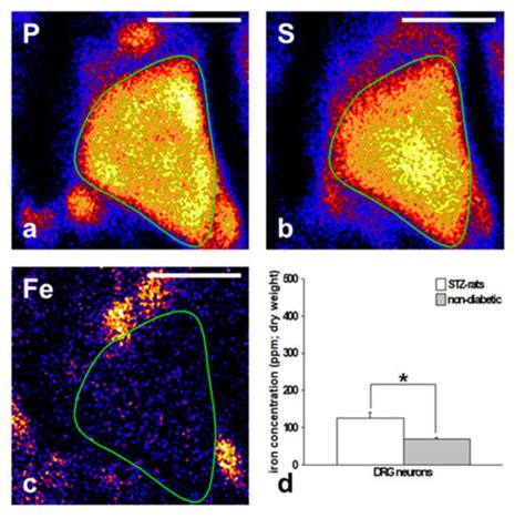 Inflammatory Mechanisms in the Pathophysiology of Diabetic Peripheral ...