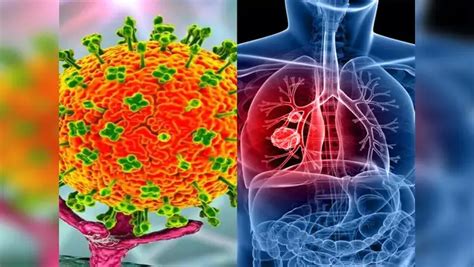 कोरोना-मंकीपॉक्स के बीच आया जानलेवा Langya virus, लीवर-किडनी पर कर रहा ...