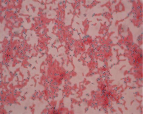 Endospore Stain Clostridium