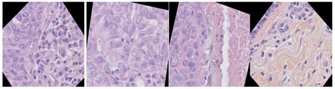 Breast Cancer Histopathological Images Segmentation Using Deep Learning
