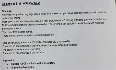 Brain CT Scan 的图像结果