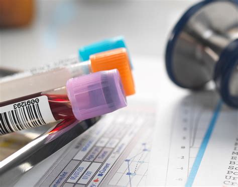 Brain natriuretic peptide test