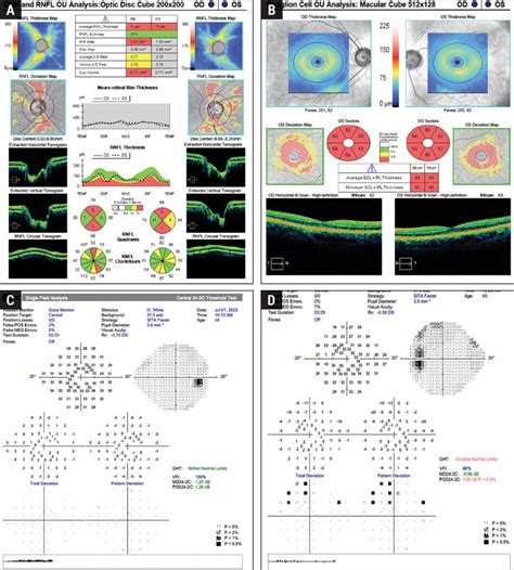 Image result for Abnormal Visual Field Testing