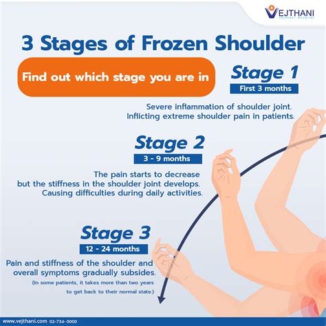 Frozen Shoulder Causes