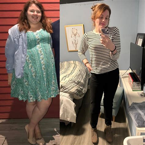 I’m 1 year post-op and down 120 pounds since then. I’m 5’10”, my weight ...