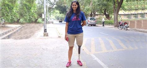She Lost A Leg In An Accident; Instead Of Giving Up, She Accepted Her ...