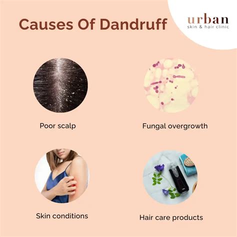 Dandruff Types, Causes, Symptoms & Treatment | USHC