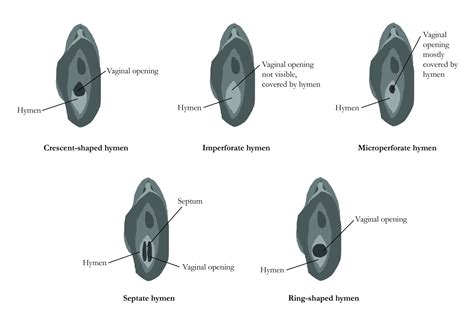 What does a normal vagina look like? A no nonsense guide to vaginas and vulvas | Woman & Home