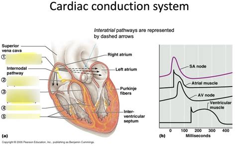 Image result for Cardiac Conduction System Disorders