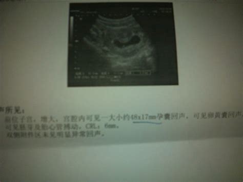 请医生帮我看看B超单子，怀孕46天，HCG：15480，孕酮10.8 能排除宫外孕吗，胚胎发育正常吗？ - 百度宝宝知道