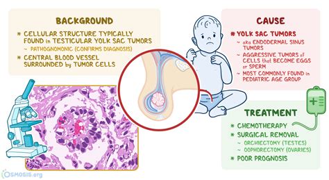 Schiller Duval Bodies: What Are They, Causes, and More | Osmosis