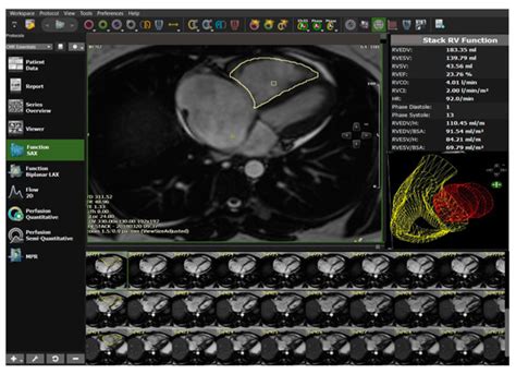 From Early Morphometrics to Machine Learning—What Future for ...