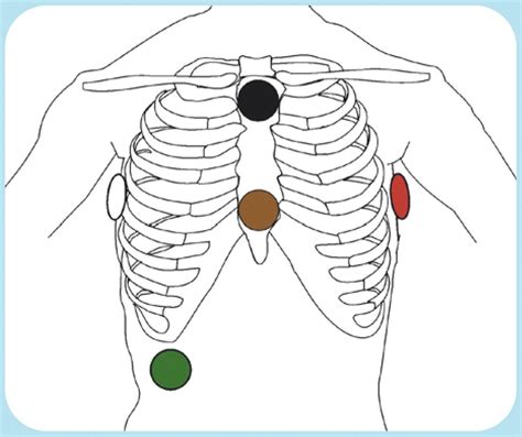 12 Lead Ecg Placement Mnemonic