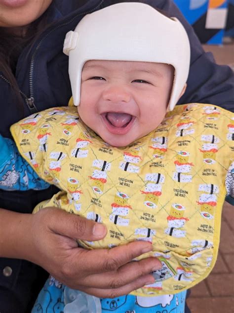 Everything You Need To Know About Head Shape Helmets and Flat Head Syndrome Prevention For Your ...