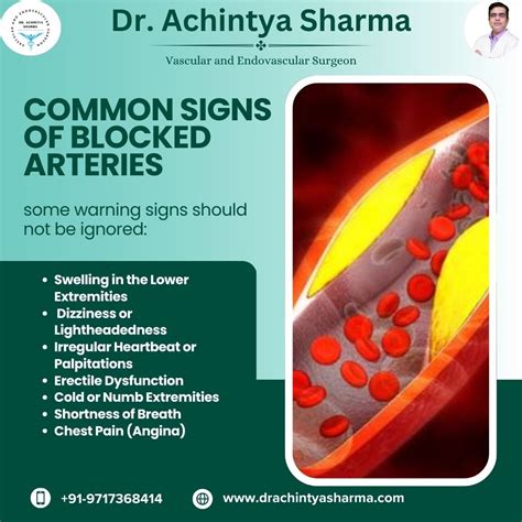"Blocked Arteries Signs: Early Symptoms and Prevention"
