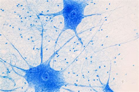 Nerve Cells Under A Microscope