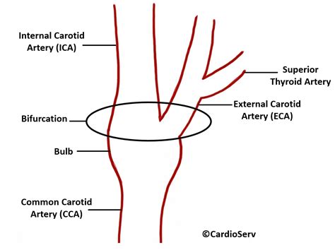 Carotid Artery Anatomy - Cardioserv