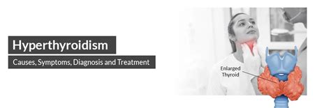 Image result for hyperthyroidism