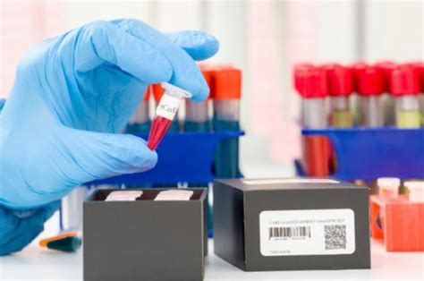 体外诊断 的图像结果