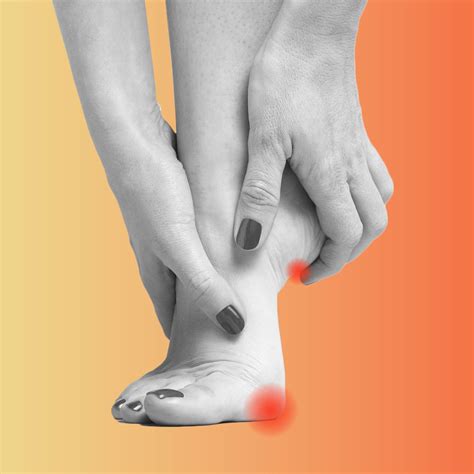 Stages Of Plantar Wart Removal Using Salicylic Acid : Types Of Warts ...