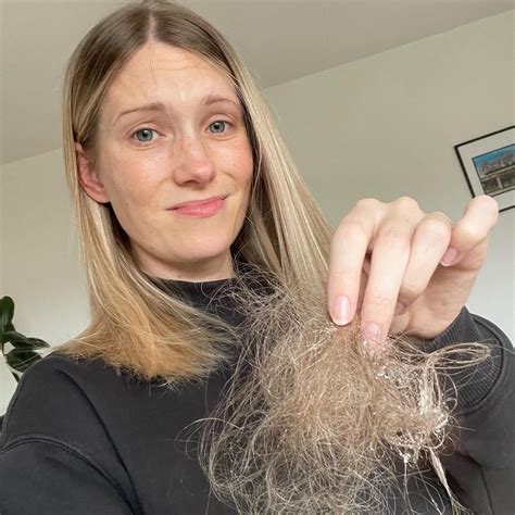 Coping with Post Partum hair loss — HumanKind Hair