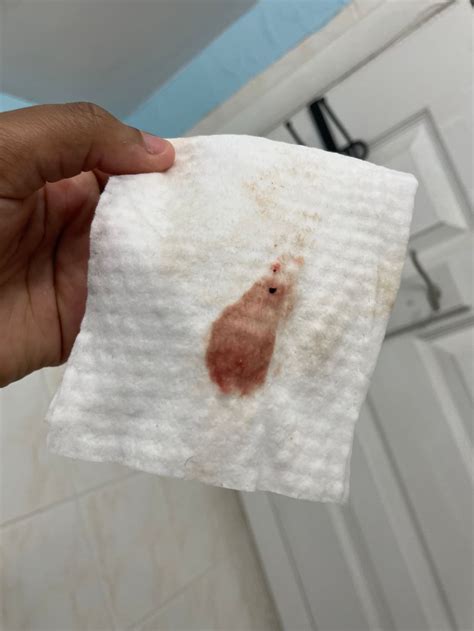 Implantation Spotting What Looks Like