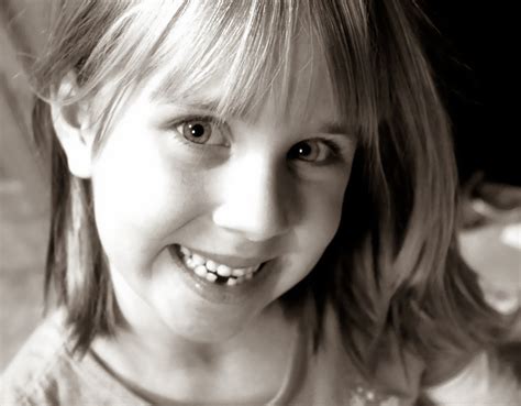 Image result for Lost Tooth