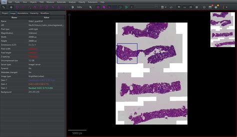 Image result for QuPath Basics