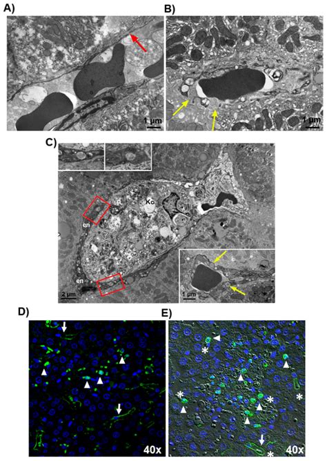 Simvastatin Prevents Liver Microthrombosis and Sepsis Induced ...