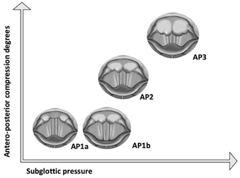 Biography of Muscle Tension Dysphonia: A Scoping Review
