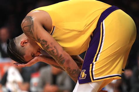 Lakers' Kyle Kuzma suffers eye abrasion