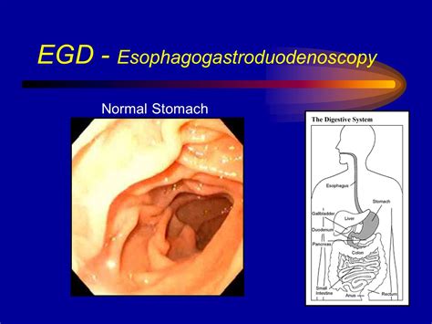 Overview: Evaluation of the Gastrointestinal Tract - ppt video online ...
