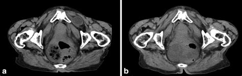 Image result for Spatial Memory Localization