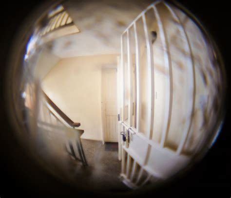 Peripheral Vision Loss: Causes, Diagnosis, & Treatment Options