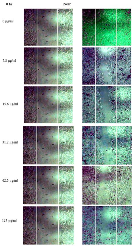 Anticancer activity of Asparagus racemosus root extracts in non-small ...