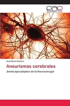 Buy Aneurismas cerebrales Book Online at Low Prices in India ...