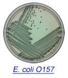 Microbial Detection using Chromogenic Media