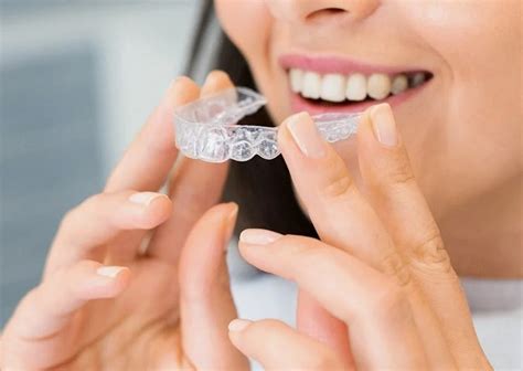 Aligners - Invisalign Bangalore