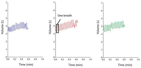 Evaluation of a Respiration Rate Sensor for Recording Tidal Volume in ...