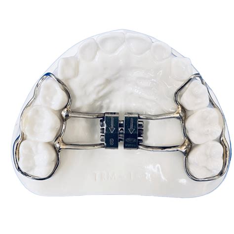 Orthodontic Jaw Expander at Rachael Sattler blog