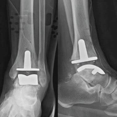 Hardware Monitor Driver 的图像结果