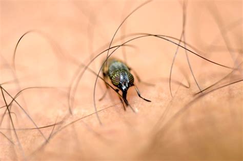 Image result for Insect Removal From Humans