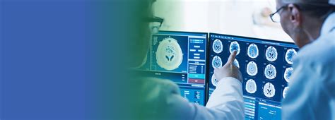 The Fundamentals Of Stroke: Risks, Symptoms And More