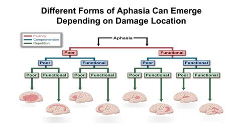 Severe Aphasia Example 的图像结果