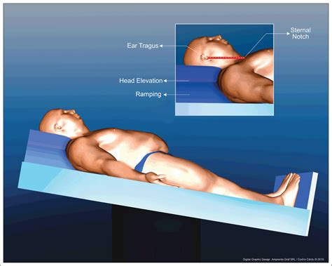 Image result for Difficult Intubation Form